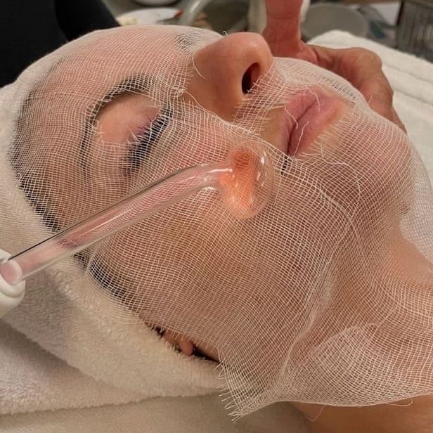 3-Month Clear Skin Reset at Skin By Ken in Midland, TX